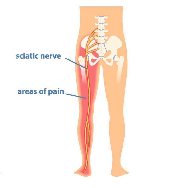 Sciatic Nerve